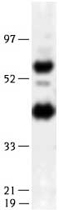 PAB12406 - LIPG