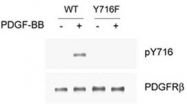 PAB1241 - CD140b / PDGFRB
