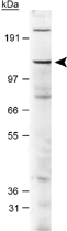 PAB12410 - JARID2 / Jumonji