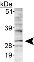 PAB12411 - INSIG1
