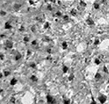 PAB12417 - HIF1AN / FIH1