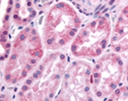 PAB12418 - HIF1A / HIF1 alpha