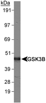 PAB12421 - GSK3 beta