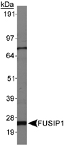 PAB12424 - SFRS13A / FUSIP1
