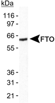 PAB12425 - FTO