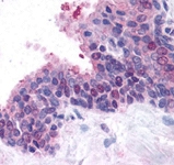 PAB12428 - FANCD2