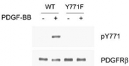PAB1243 - CD140b / PDGFRB