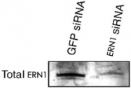 PAB12433 - ERN1 / IRE1
