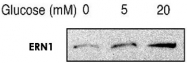 PAB12435 - ERN1 / IRE1
