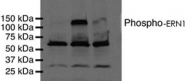 PAB12435 - ERN1 / IRE1