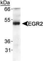 PAB12439 - EGR2