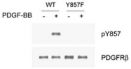 PAB1244 - CD140b / PDGFRB