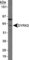 PAB12442 - DYRK2