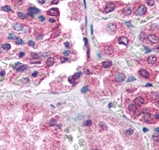 PAB12446 - Dynamin-1-like protein