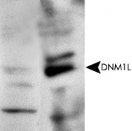 PAB12447 - Dynamin-1-like protein