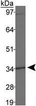 PAB12448 - DLX4 / BP1