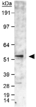 PAB12453 - Aromatase