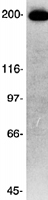 PAB12456 - CKAP5