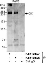 PAB12458 - CIC