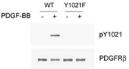 PAB1246 - CD140b / PDGFRB