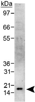 PAB12465 - CBX5