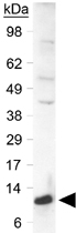 PAB12467 - SLIRP
