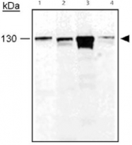 PAB12468 - BRIP1 / FANCJ