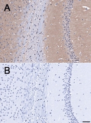 PAB12475 - BAI1
