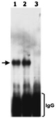 PAB12476 - ATRIP / AGS1