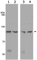 PAB12476 - ATRIP / AGS1