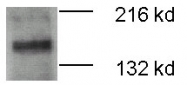 PAB12477 - ATP7B