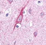 PAB12479 - ATP13A2 / PARK9