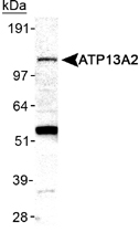 PAB12479 - ATP13A2 / PARK9