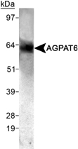 PAB12492 - AGPAT6