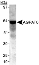 PAB12493 - AGPAT6
