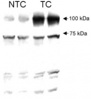 PAB12494 - AGGF1 / VG5Q
