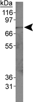 PAB12497 - ACSL1
