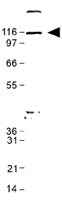PAB12499 - ABL1