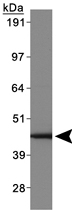 PAB12500 - ABHD5