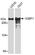 PAB12506 - TP53BP1