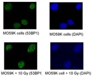 PAB12506 - TP53BP1