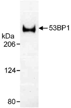 PAB12507 - TP53BP1