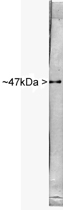 PAB12508 - Neuron specific enolase