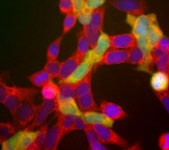 PAB12508 - Neuron specific enolase
