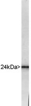PAB12509 - UCHL1 / PGP9.5
