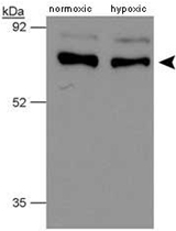 PAB12516 - P4HTM / PH4