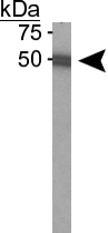 PAB12517 - Beclin-1-like protein 1