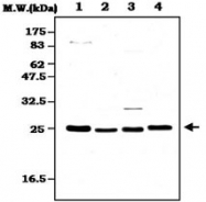 PAB1252 - Peroxiredoxin-2 / PRDX2