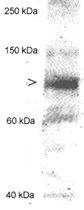 PAB12520 - MLXIPL