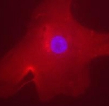 PAB12520 - MLXIPL